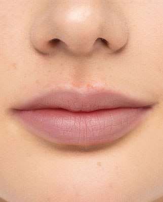 Lippen nach einem Lippen-Peeling werden gezeigt