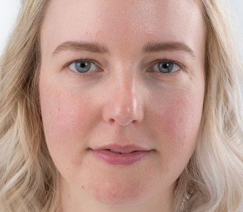 Vorher- und Nachher-Effekt beim Schminktipp Make-up bei Hautproblemen